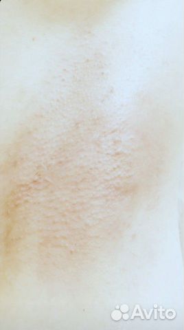 Шугаринг, Воск (Куркино, Химки) Шугаринг, Воск (Куркино, Химки)